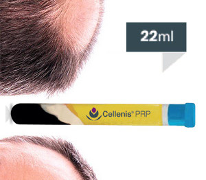 hair-loss-clinic-earls-court-prp-22-ml